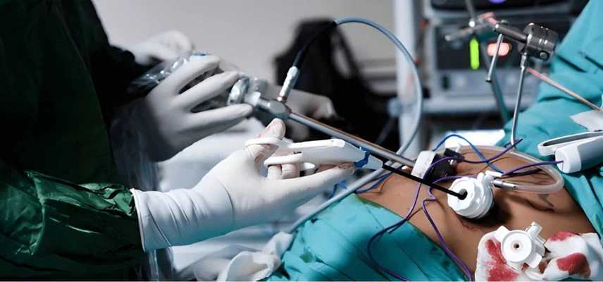 General Laparoscopic Surgeries